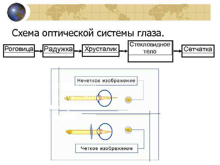 Схема оптической системы глаза. Роговица Радужка Хрусталик X. Какое заболевание глаз и метод его