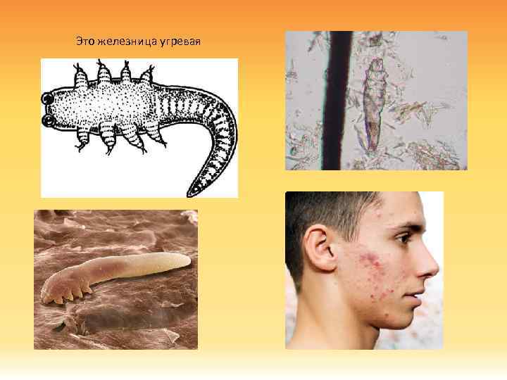 Это железница угревая 