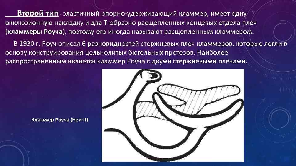 3 тип нея. Опорно-удерживающий кламмер Аккера. Кламмер Аккера Роуча. Кламмер 1 типа (Аккера). 2 Тип кламмера системы нея.