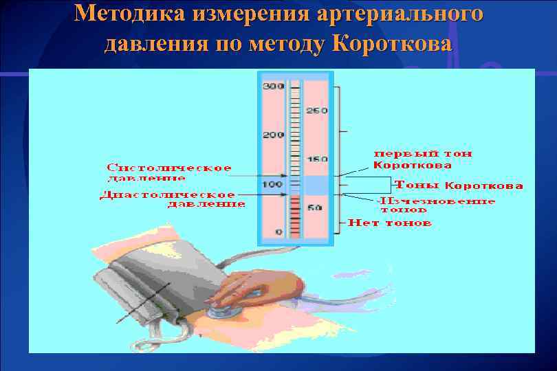 Методика измерения артериального давления по методу Короткова 