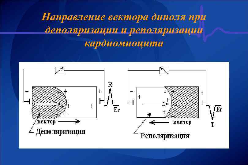 Направление вектора диполя при деполяризации и реполяризации кардиомиоцита 