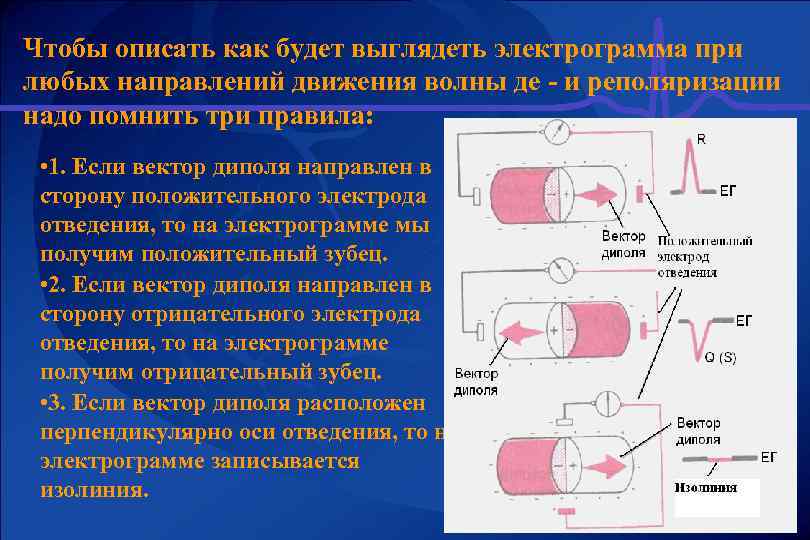 Чтобы описать как будет выглядеть электрограмма при любых направлений движения волны де - и