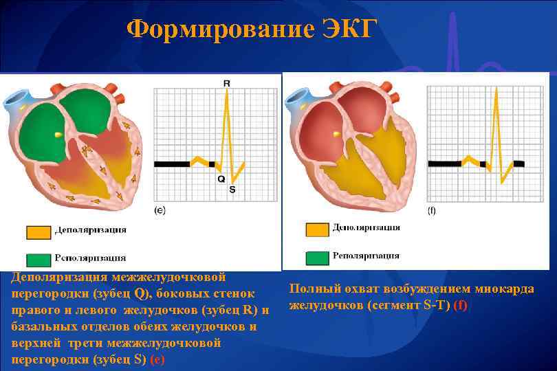 Формирование ЭКГ Деполяризация межжелудочковой перегородки (зубец Q), боковых стенок правого и левого желудочков (зубец