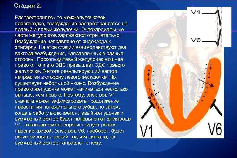 Левый желудочек мощнее правого. Парадоксальное движение межжелудочковой перегородки. Возбуждение межжелудочковой перегородки. Возбуждение межжелудочковой перегородки на ЭКГ. Парадоксальное движение МЖП.