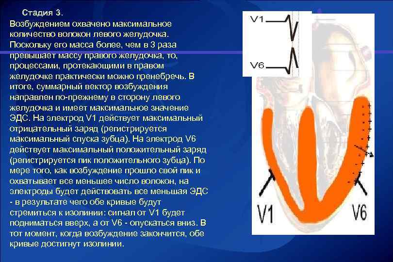 Стадия 3. Возбуждением охвачено максимальное количество волокон левого желудочка. Поскольку его масса более, чем