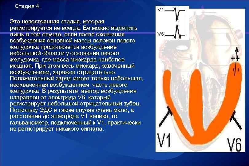 Стадия 4. Это непостоянная стадия, которая регистрируется не всегда. Ее можно выделить лишь в