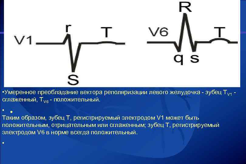  • Умеренное преобладание вектора реполяризации левого желудочка зубец TV 1 сглаженный, TV 6