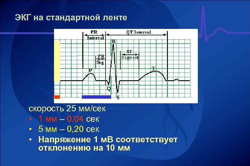 Мм экг. Вольтаж ЭКГ 5 мм. Скорость записи ЭКГ 50 мм с. Скоростная лента ЭКГ 50. Вольтаж на ЭКГ 50 мм.