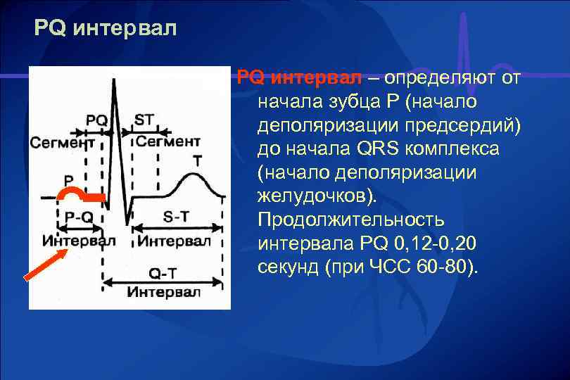 П нормальная. Интервал PQ на ЭКГ. Происхождение интервала PQ на ЭКГ. Удлинение интервала PQ на ЭКГ. ЭКГ интервал PQ 140 МС.