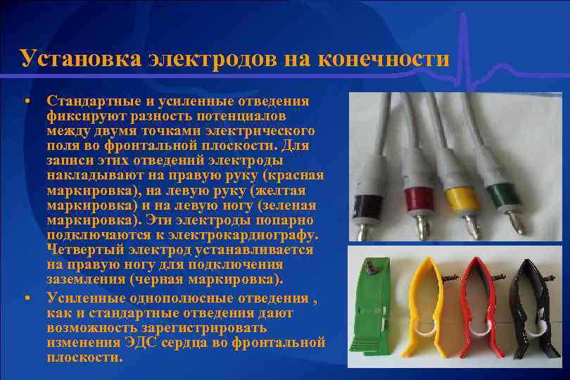 Установка электродов на конечности • • Стандартные и усиленные отведения фиксируют разность потенциалов между