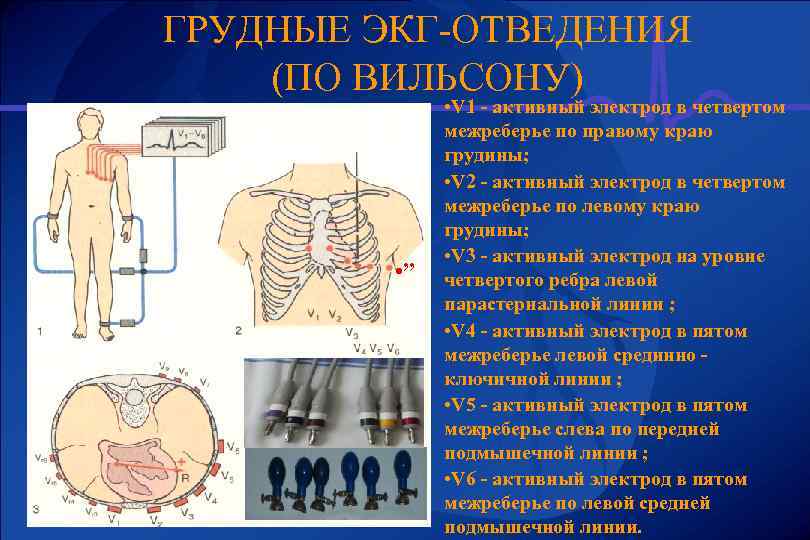 ГРУДНЫЕ ЭКГ-ОТВЕДЕНИЯ (ПО ВИЛЬСОНУ) • ” • V 1 - активный электрод в четвертом