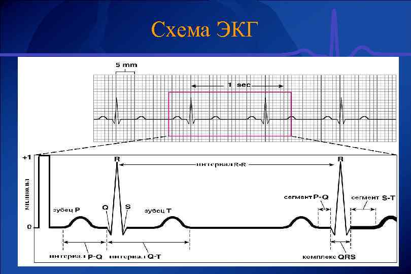 Схема ЭКГ 