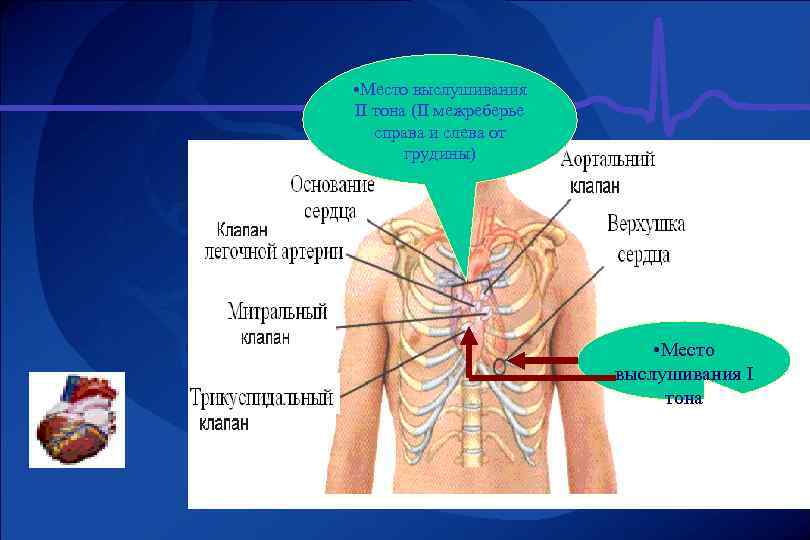  • Место выслушивания ІІ тона (ІІ межреберье справа и слева от грудины) •