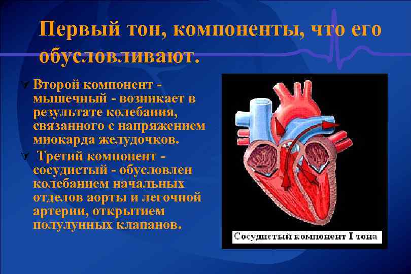 Первый тон, компоненты, что его обусловливают. Ú Второй компонент - мышечный - возникает в