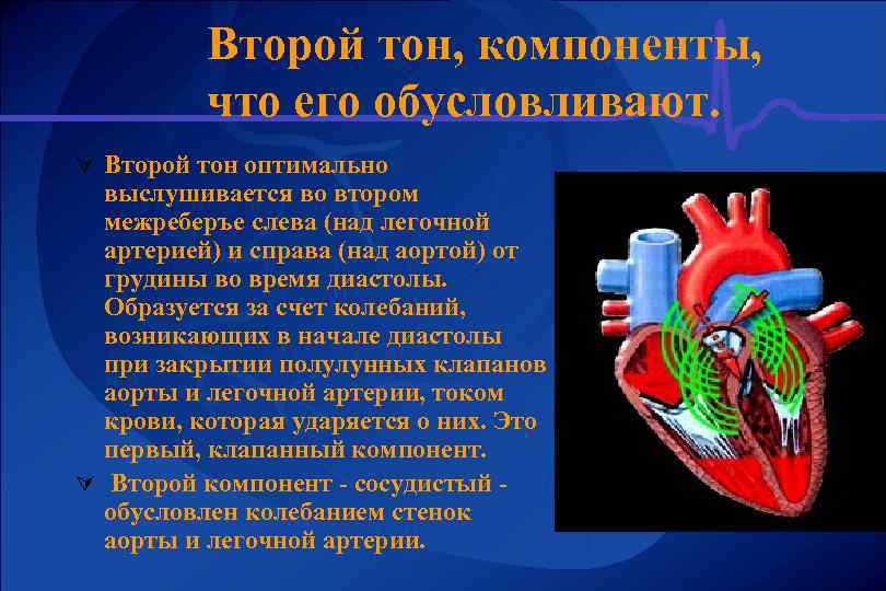 Второй тон, компоненты, что его обусловливают. Ú Второй тон оптимально выслушивается во втором межреберъе