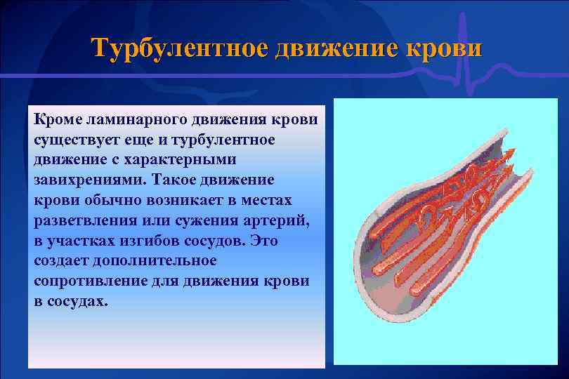 Турбулентное движение крови Кроме ламинарного движения крови существует еще и турбулентное движение с характерными