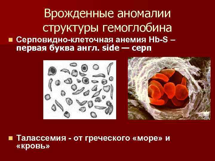 Ионы железа входят в состав гемоглобина крови. Структура серповидно- клеточного гемоглобина. Аномалии гемоглобина. Серповидно клеточная анемия малярийный плазмодий. Воспаление суставов от серповидно клеточной анемии.