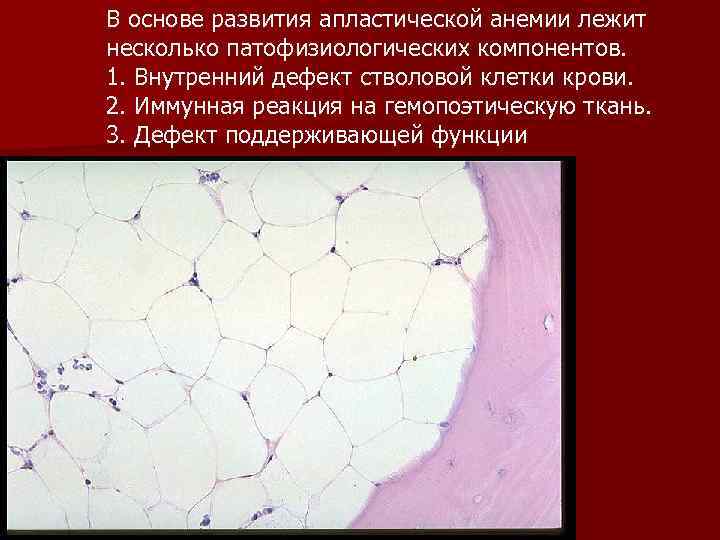 В основе развития апластической анемии лежит несколько патофизиологических компонентов. 1. Внутренний дефект стволовой клетки