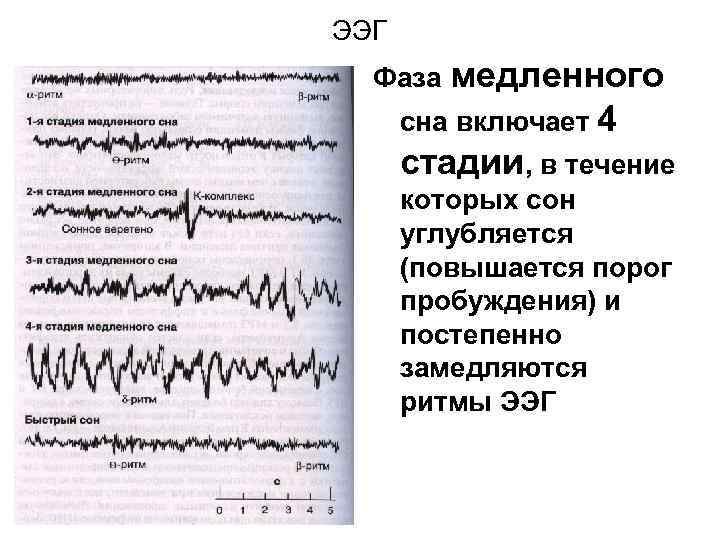 ЭЭГ Фаза медленного сна включает 4 стадии, в течение которых сон углубляется (повышается порог