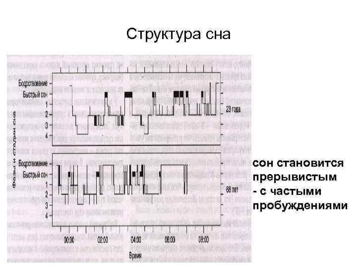 Структура сна сон становится прерывистым - с частыми пробуждениями 