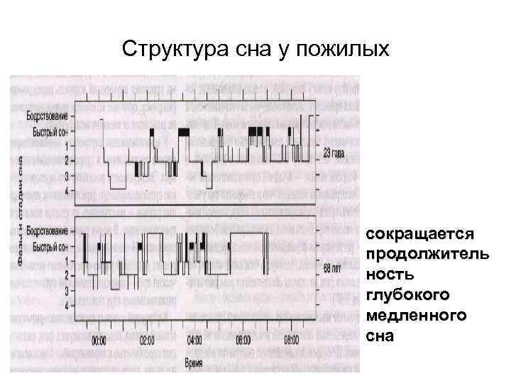 Структура сна у пожилых сокращается продолжитель ность глубокого медленного сна 