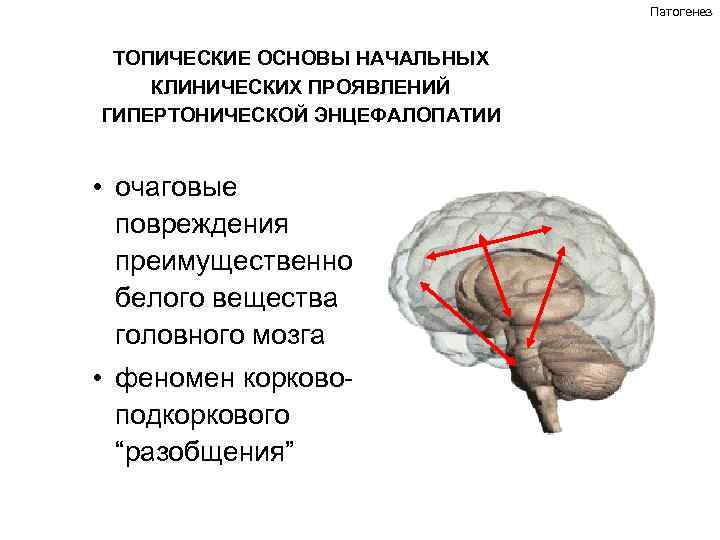 Патогенез ТОПИЧЕСКИЕ ОСНОВЫ НАЧАЛЬНЫХ КЛИНИЧЕСКИХ ПРОЯВЛЕНИЙ ГИПЕРТОНИЧЕСКОЙ ЭНЦЕФАЛОПАТИИ • очаговые повреждения преимущественно белого вещества