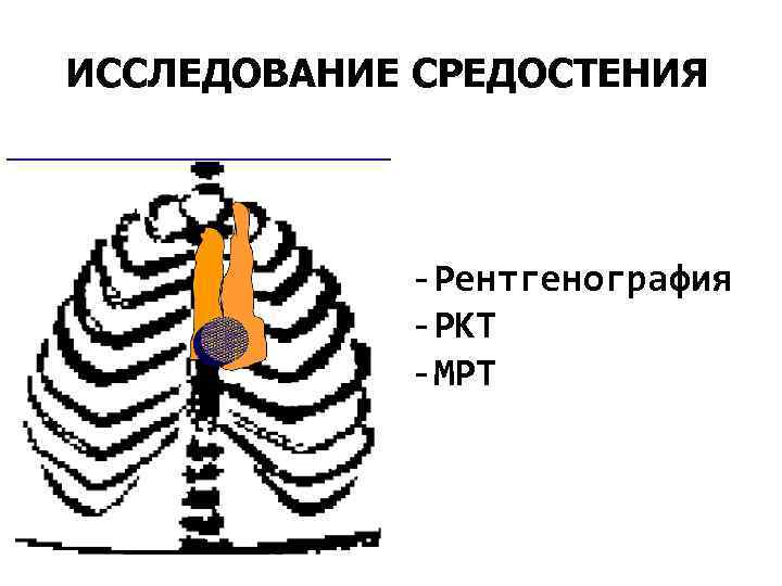 ИССЛЕДОВАНИЕ СРЕДОСТЕНИЯ -Рентгенография -РКТ -МРТ 