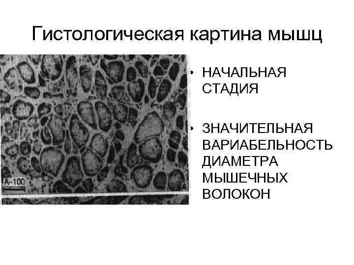 Треугольник крейбиха гистологическая картина