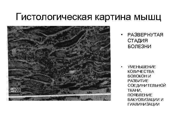 Аллопластическая картина болезни