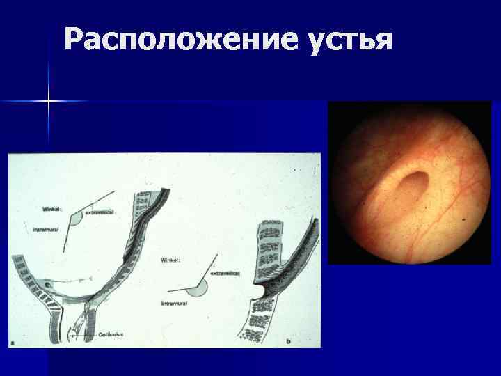 Расположение устья 