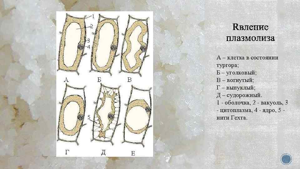А – клетка в состоянии тургора; Б – уголковый; В – вогнутый; Г –