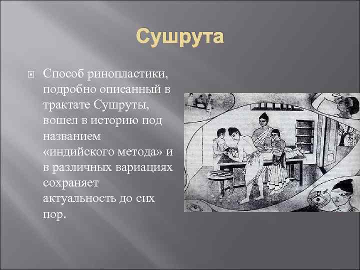 Сушрута Способ ринопластики, подробно описанный в трактате Сушруты, вошел в историю под названием «индийского