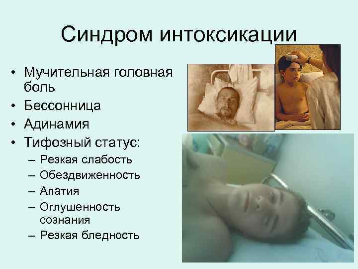 Синдром интоксикации • Мучительная головная боль • Бессонница • Адинамия • Тифозный статус: –