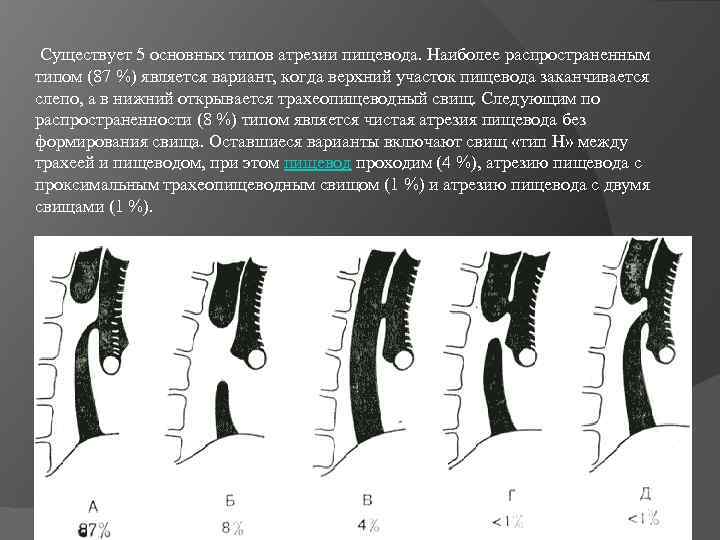  Существует 5 основных типов атрезии пищевода. Наиболее распространенным типом (87 %) является вариант,