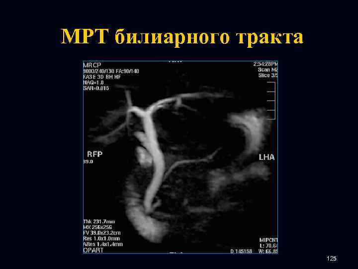 МРТ билиарного тракта 125 