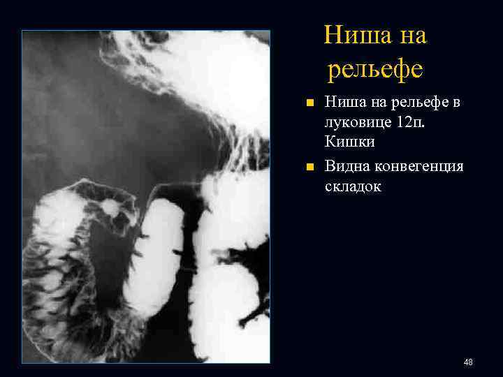 Ниша на рельефе n n Ниша на рельефе в луковице 12 п. Кишки Видна