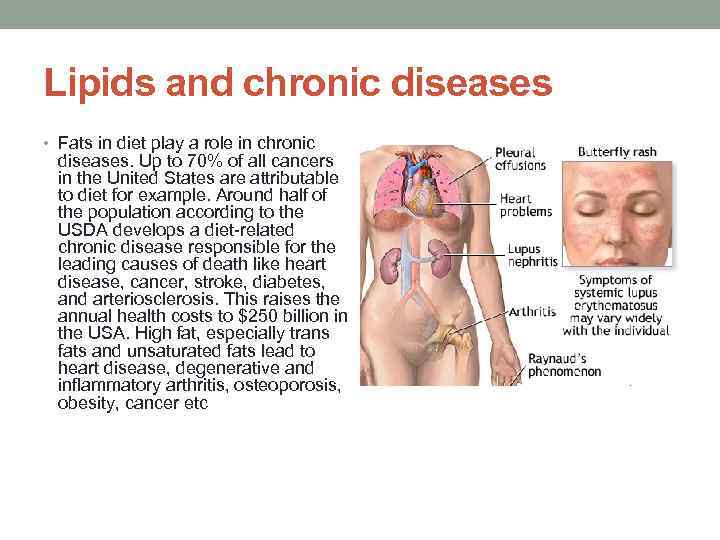 Lipids and chronic diseases • Fats in diet play a role in chronic diseases.