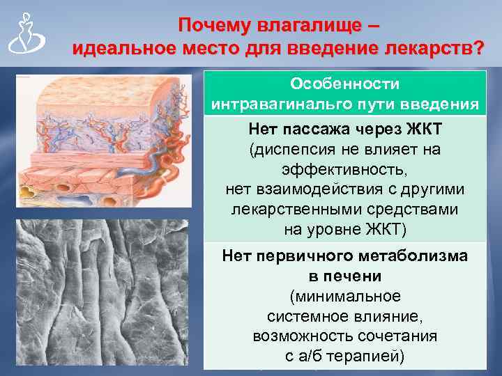 Почему влагалище – идеальное место для введение лекарств? ü Слизистая тонкая, представлена Особенности многослойным