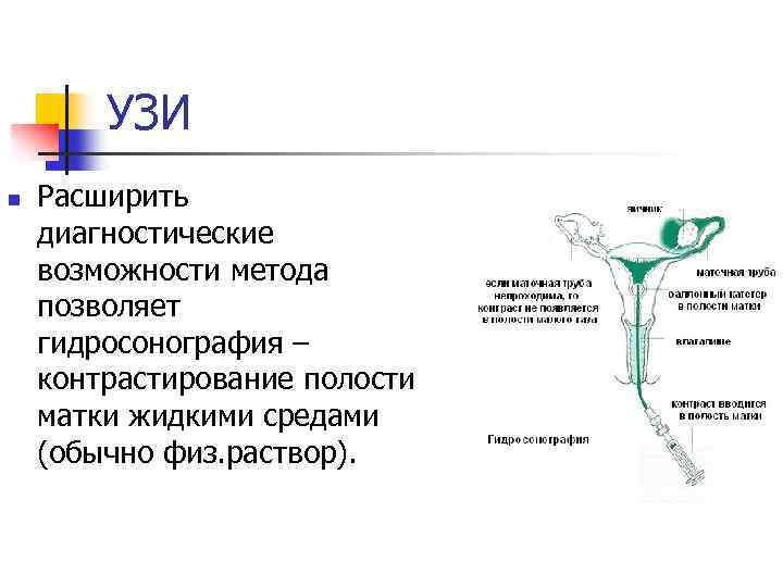 УЗИ n Расширить диагностические возможности метода позволяет гидросонография – контрастирование полости матки жидкими средами