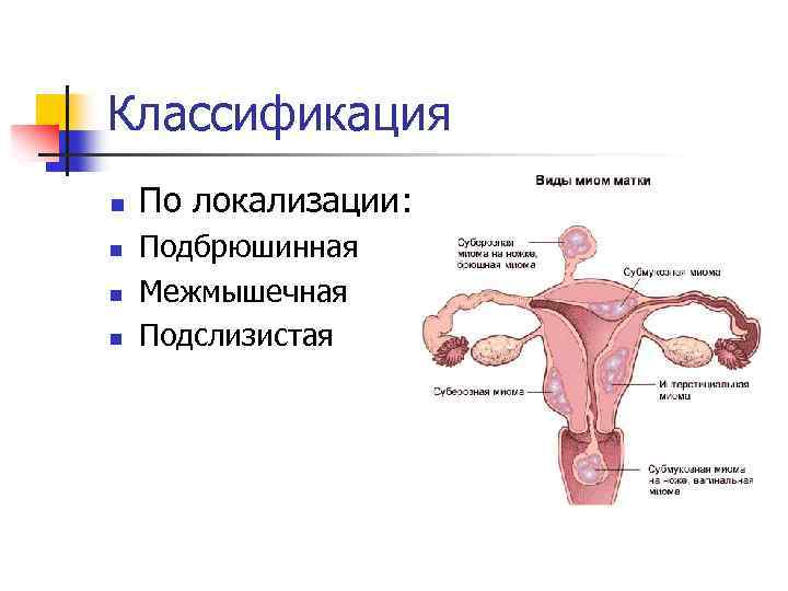 Классификация n n По локализации: Подбрюшинная Межмышечная Подслизистая 