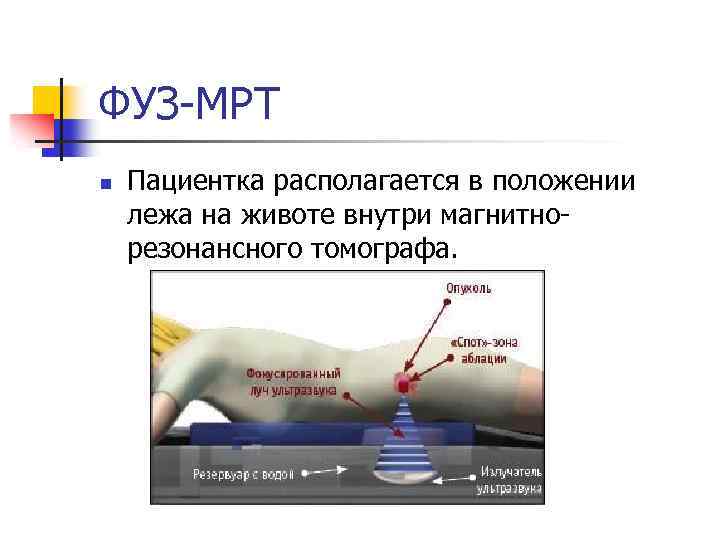 ФУЗ-МРТ n Пациентка располагается в положении лежа на животе внутри магнитнорезонансного томографа. 