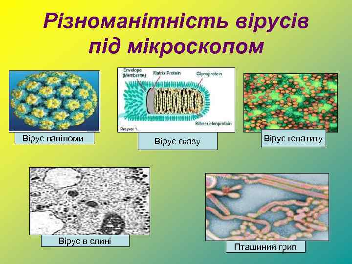 Різноманітність вірусів під мікроскопом Вірус папіломи Вірус в слині Вірус сказу Вірус гепатиту Пташиний