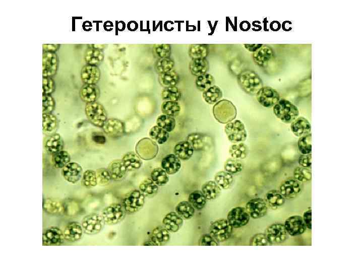 Гетероцисты у Nostoc 