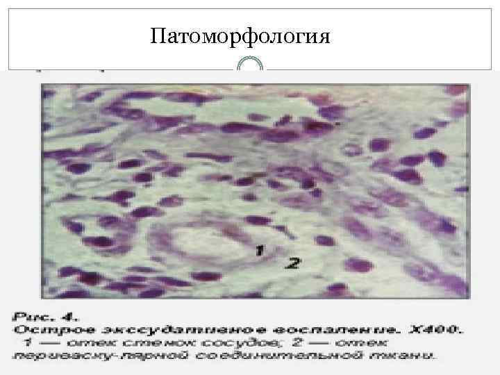 Патоморфологическая картина это
