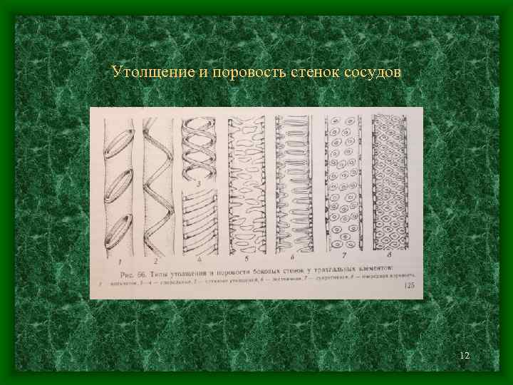 Утолщение и поровость стенок сосудов 12 