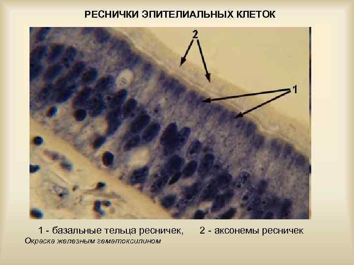 РЕСНИЧКИ ЭПИТЕЛИАЛЬНЫХ КЛЕТОК 1 - базальные тельца ресничек, 2 - аксонемы ресничек Окраска железным