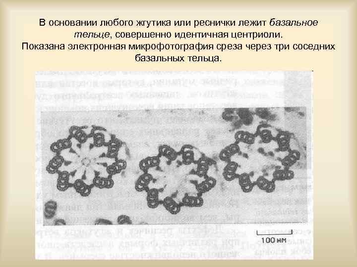 В основании любого жгутика или реснички лежит базальное тельце, совершенно идентичная центриоли. Показана электронная