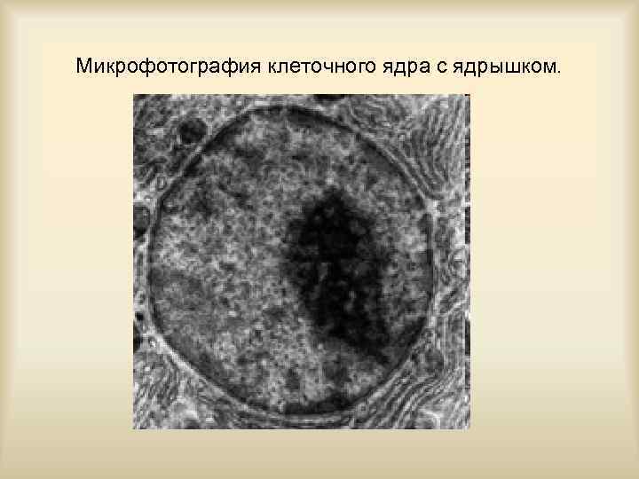 Микрофотография клеточного ядра с ядрышком. 