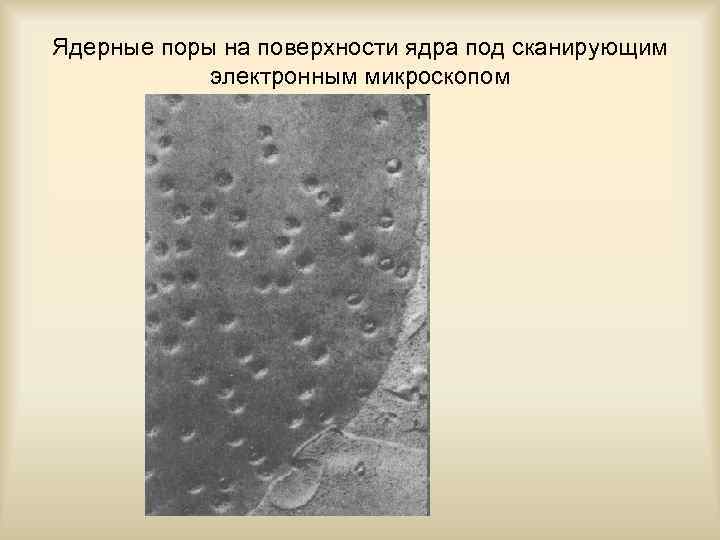 Ядерные поры на поверхности ядра под сканирующим электронным микроскопом 