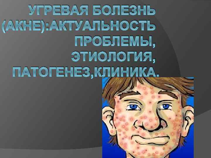 УГРЕВАЯ БОЛЕЗНЬ (АКНЕ): АКТУАЛЬНОСТЬ ПРОБЛЕМЫ, ЭТИОЛОГИЯ, ПАТОГЕНЕЗ, КЛИНИКА. 